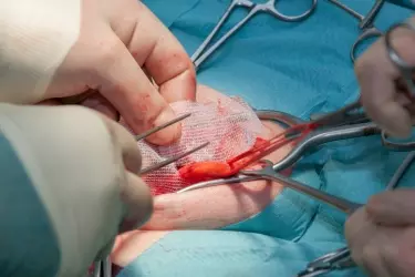 best hospital for hernia repair surgery in madhepura, best doctor for hernia treatment in madhepura, cost of hernia surgery in madhepura