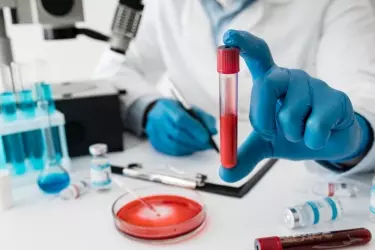 best pathology lab in madhepura, best lab for blood test in madhepura, best nabl lab in madhepura