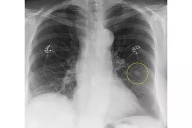 best hospital for digital x-ray test in madhepura, best doctor for digital x-ray test in madhepura, cost of digital x-ray test in madhepura